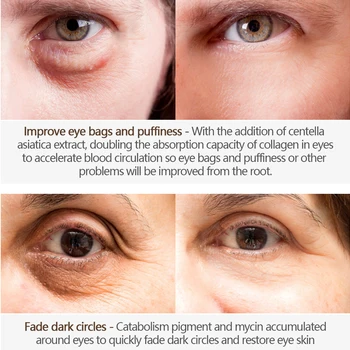 20 g Eye Cream Anti-Aging Vrásky Peptid Kolagén Sérum Odstraňovač Tmavé Kruhy Proti Opuchy A Tašky Hydratačný Očná Starostlivosť